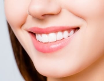 Dental Bonding Cosmetic Dentistry - Wodonga Family Dental Clinic